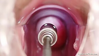 Amateur Blonde Gets Her Holes Stretched By A Doctor And His Sex Toy